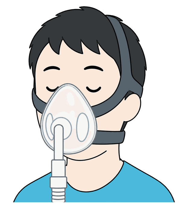 CPAP療法のイラスト。マスクを装着して眠っている様子のイメージ図